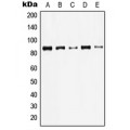 LifeSab™ Gamma-catenin Rabbit pAb (50 µl)