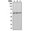LifeSab™ Cytokeratin 14/16 Rabbit pAb (50 µl)