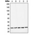 LifeSab™ Galectin 3 Rabbit pAb (50 µl)