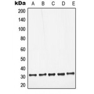 LifeSab™ Galectin 3 Rabbit pAb (50 µl)