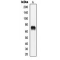 LifeSab™ LIMK1/2 (pT508/505) Rabbit pAb (50 µl)