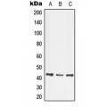 LifeSab™ LMX1B Rabbit pAb (50 µl)