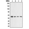 LifeSab™ MMP3 Rabbit pAb (50 µl)