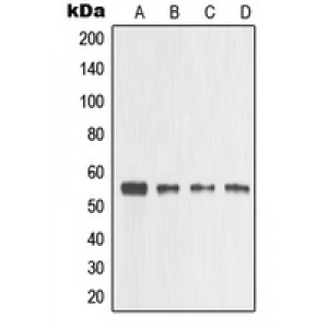LifeSab™ MMP3 Rabbit pAb (50 µl)