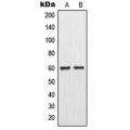 LifeSab™ MMP11 Rabbit pAb (50 µl)
