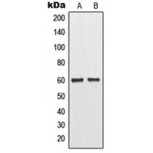 LifeSab™ MMP11 Rabbit pAb (50 µl)