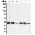 LifeSab™ MMP13 Rabbit pAb (50 µl)