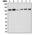 LifeSab™ NF-kappaB p105 (pS927) Rabbit pAb (50 µl)