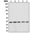LifeSab™ IKB beta (pS23) Rabbit pAb (50 µl)