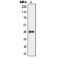 LifeSab™ Nucleophosmin (pT199) Rabbit pAb (50 µl)
