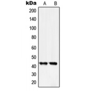 LifeSab™ Serpin B5 Rabbit pAb (50 µl)