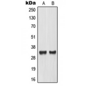 LifeSab™ TCFL4 Rabbit pAb (50 µl)