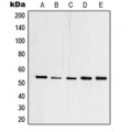 LifeSab™ TFDP1 Rabbit pAb (50 µl)