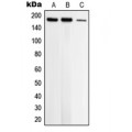LifeSab™ Topoisomerase 2 beta Rabbit pAb (50 µl)