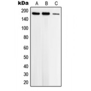 LifeSab™ Topoisomerase 2 beta Rabbit pAb (50 µl)