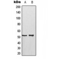 LifeSab™ p53 (pS315) Rabbit pAb (50 µl)