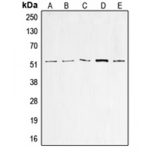 LifeSab™ p53 Rabbit pAb (50 µl)