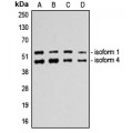LifeSab™ p53 Rabbit pAb (50 µl)
