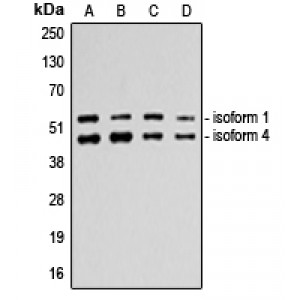LifeSab™ p53 Rabbit pAb (50 µl)