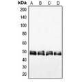 LifeSab™ VASP Rabbit pAb (50 µl)