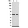 LifeSab™ Cytochrome P450 4F2 Rabbit pAb (50 µl)