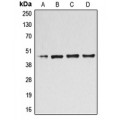 LifeSab™ B4GALT3 Rabbit pAb (50 µl)