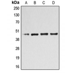 LifeSab™ B4GALT3 Rabbit pAb (50 µl)