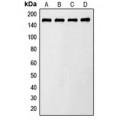 LifeSab™ AS160 (pT642) Rabbit pAb (50 µl)
