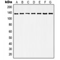 LifeSab™ Histone Deacetylase 6 Rabbit pAb (50 µl)