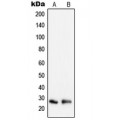 LifeSab™ Peroxiredoxin 3 Rabbit pAb (50 µl)