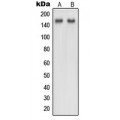 LifeSab™ NUP160 Rabbit pAb (50 µl)