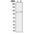 LifeSab™ JIP2 Rabbit pAb (50 µl)