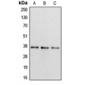 LifeSab™ Apolipoprotein L2 Rabbit pAb (50 µl)