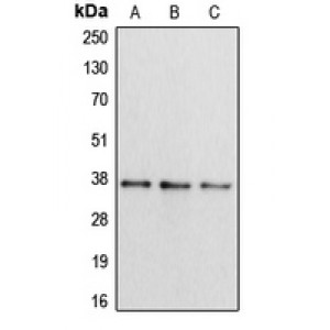 LifeSab™ Apolipoprotein L2 Rabbit pAb (50 µl)