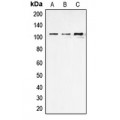 LifeSab™ ERAP1 Rabbit pAb (50 µl)