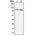 LifeSab™ CABC1 Rabbit pAb (50 µl)
