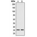 LifeSab™ CTDSP1 Rabbit pAb (50 µl)