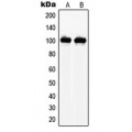 LifeSab™ NAA15 Rabbit pAb (50 µl)