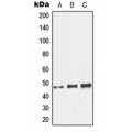 LifeSab™ GCNT7 Rabbit pAb (50 µl)
