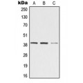 LifeSab™ ZADH2 Rabbit pAb (50 µl)