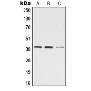 LifeSab™ ZADH2 Rabbit pAb (50 µl)