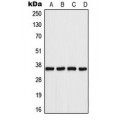 LifeSab™ Aldose Reductase Rabbit pAb (50 µl)