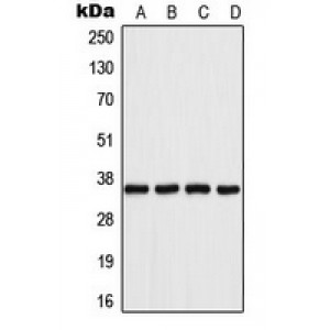 LifeSab™ Aldose Reductase Rabbit pAb (50 µl)