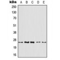 LifeSab™ ARF4 Rabbit pAb (50 µl)