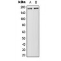LifeSab™ HER2 Rabbit pAb (50 µl)