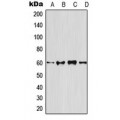 LifeSab™ Osteoprotegerin Rabbit pAb (50 µl)
