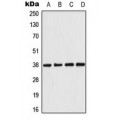 LifeSab™ AMPK beta 1 Rabbit pAb (50 µl)