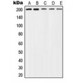 LifeSab™ TSC2 (pT1462) Rabbit pAb (50 µl)