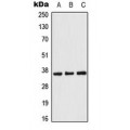 LifeSab™ ACOT8 Rabbit pAb (50 µl)