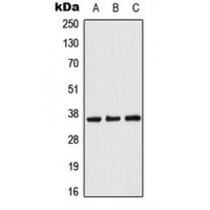 LifeSab™ ACOT8 Rabbit pAb (50 µl)